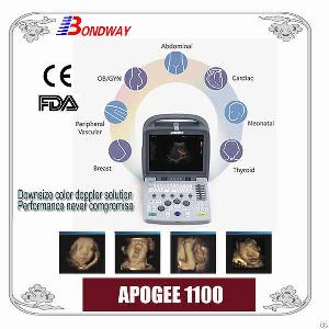 digital doppler ultrasound diagnostic system sonography instrument hand carry