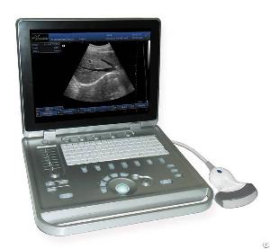 Ss-9 Pc Based Laptop Ultrasound B Scanner Ultrasound, Ultrasoni, Scanner