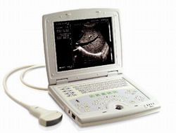 Full Digital Laptop Ultrasound Scanner Rsd-rd8b Human