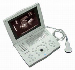 Laptop Ultrasound Scanner