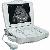 Rsd-rp6a Plus Human Full Digital Laptop Ultrasound Scanner Made In Ronseda